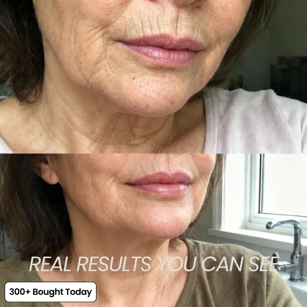 Transform Wrinkles, Fine Lines, And Tired Creases Naturally